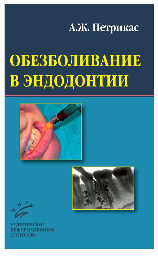 Обезболивание в эндодонтии #1