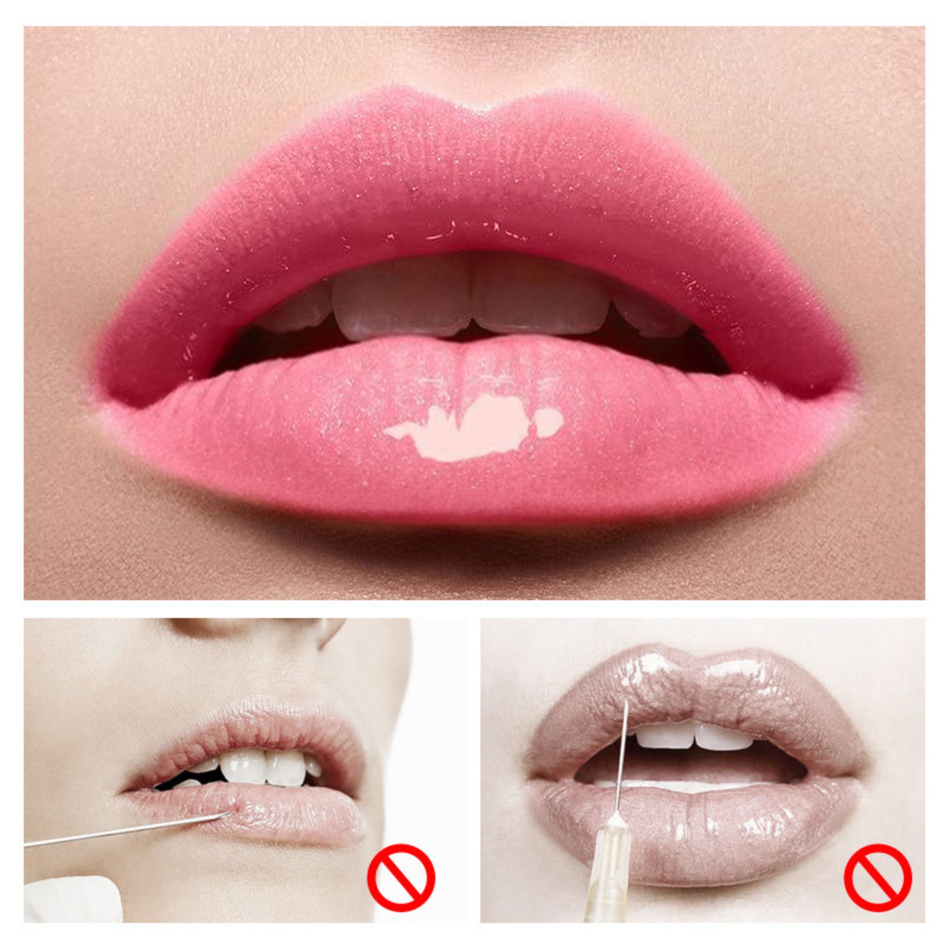 Увеличение губ lips