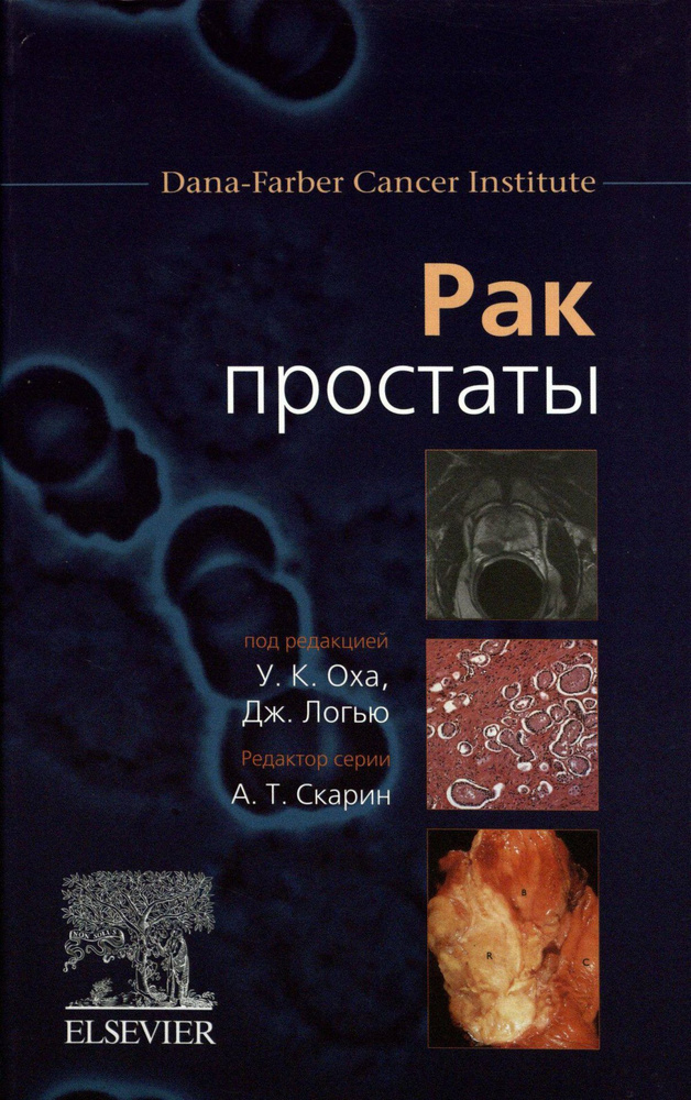 Рак простаты #1