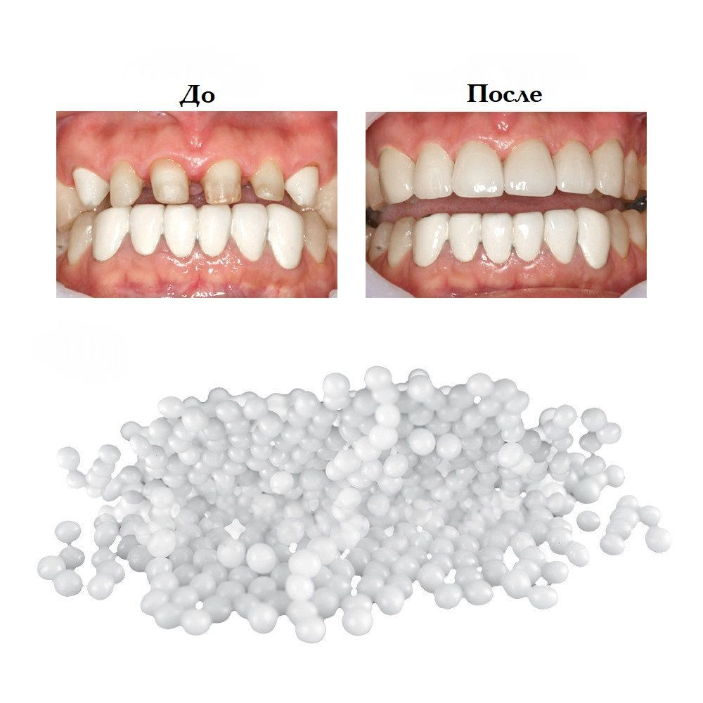 Материал пломбировочный временный (Кольтасол). Пломба для ремонта и ...