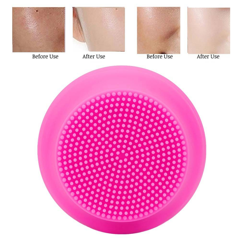 Аппарат для чистки лица - купить с доставкой по выгодным ценам в ...