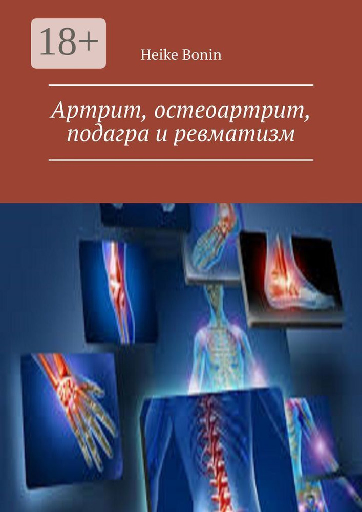 Артрит, остеоартрит, подагра и ревматизм | Bonin Heike #1