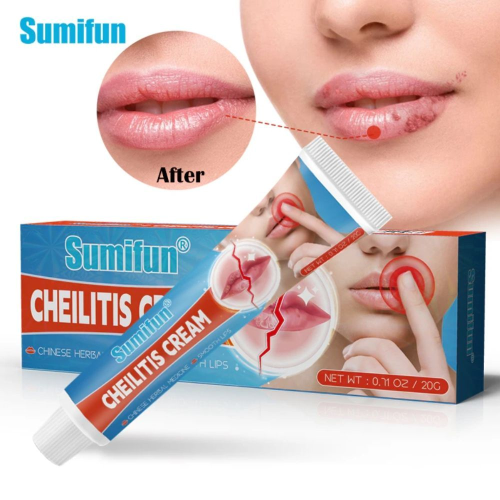 Sumifun Средство для лечения герпеса Cheilitis Cream 20гр - купить с  доставкой по выгодным ценам в интернет-магазине OZON (1196708249)