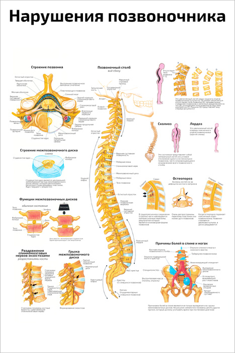 Нарушения позвоночника