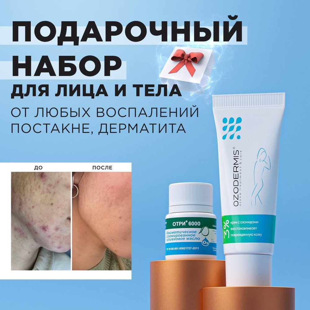 Подарочный набор для ухода за проблемной кожей "STOP ACNE BOX" : Крем для лица и тела Озодермис и озонированное #1