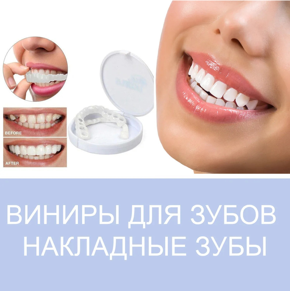 Виниры (накладки) на зубы – цена в Краснодаре