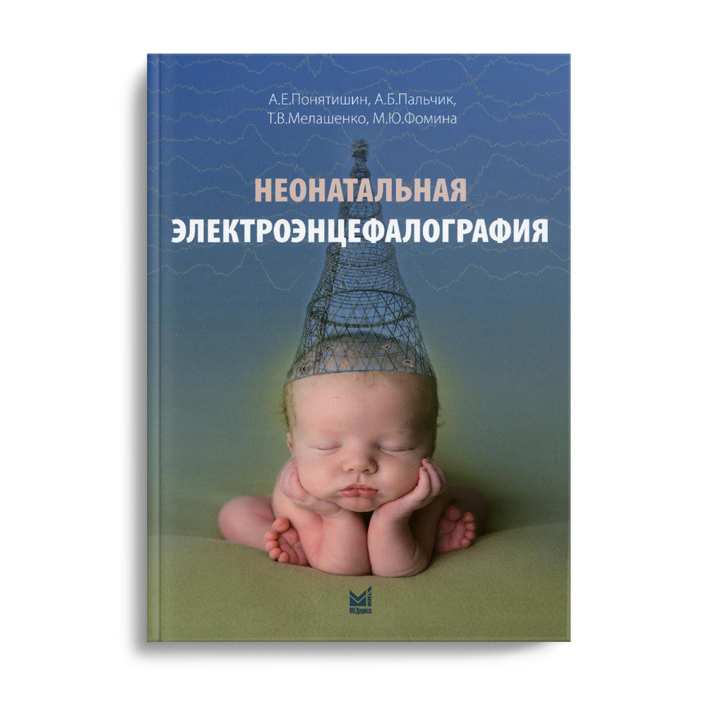 Неонатальная электроэнцефалография | Понятишин Андрей Евстахиевич, Пальчик  Александр Бейнусович