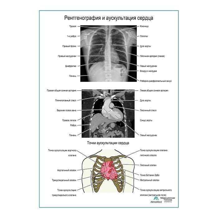 Рентгенография и аускультация сердца плакат глянцевый А2+, плотная фотобумага от 200г/м2  #1