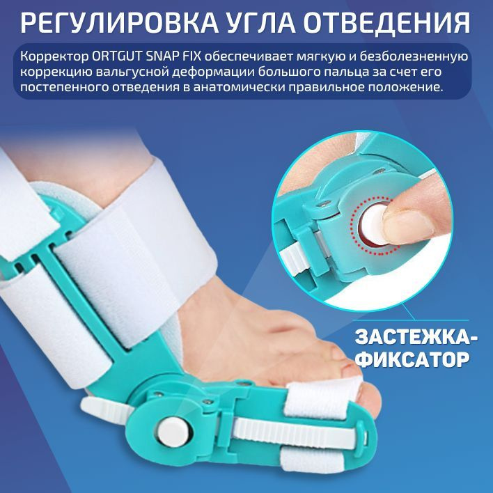 Вальгусная шарнирная шина ORTGUT SNAP FIX с регулировкой угла ...