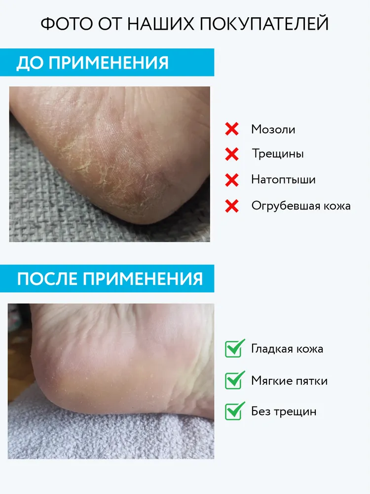 ARAVIA Professional Гель-пенка Liquid Peel-Foam для удаления мозолей и натоптышей, 160 мл, 160 мл, фото 2