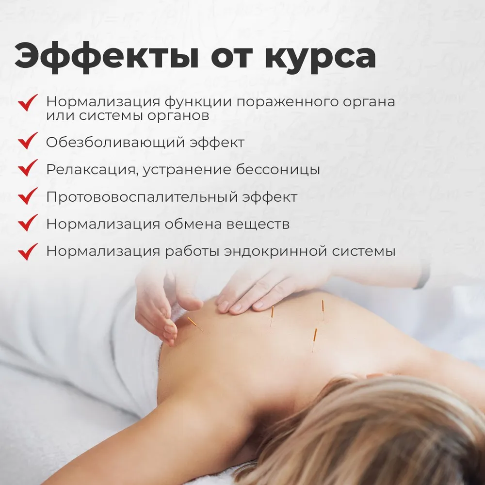 Иглы акупунктурные мед сталь 0,3х50 мм с направителем 100шт, 0.3x50 мм, 100 шт, фото 3