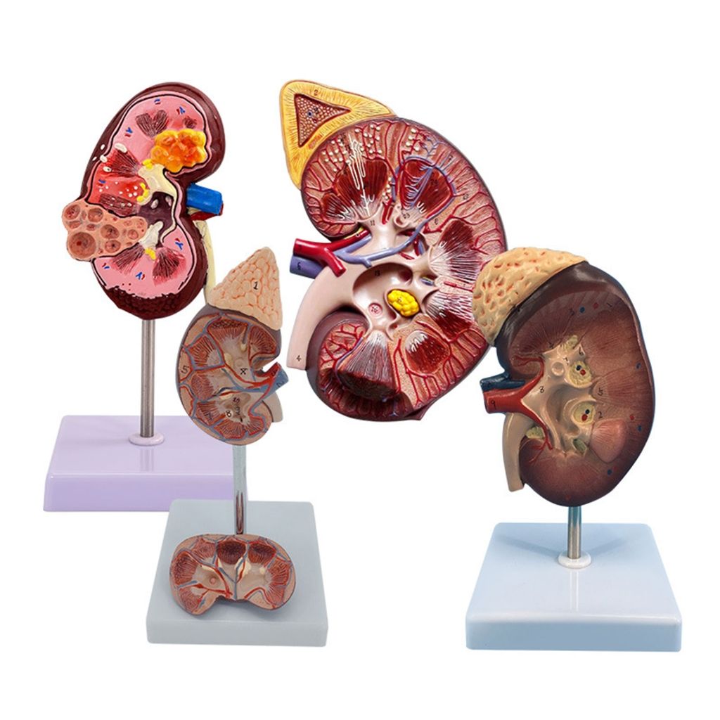 National Kidney Foundation Launches Initiative to Modernize eGFR Testing