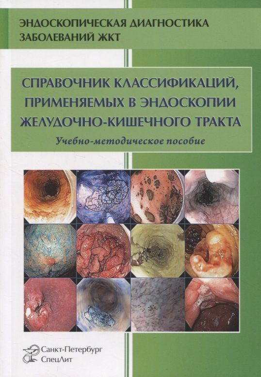 Справочник классификаций, применяемых в эндоскопии желудочно-кишечного ...