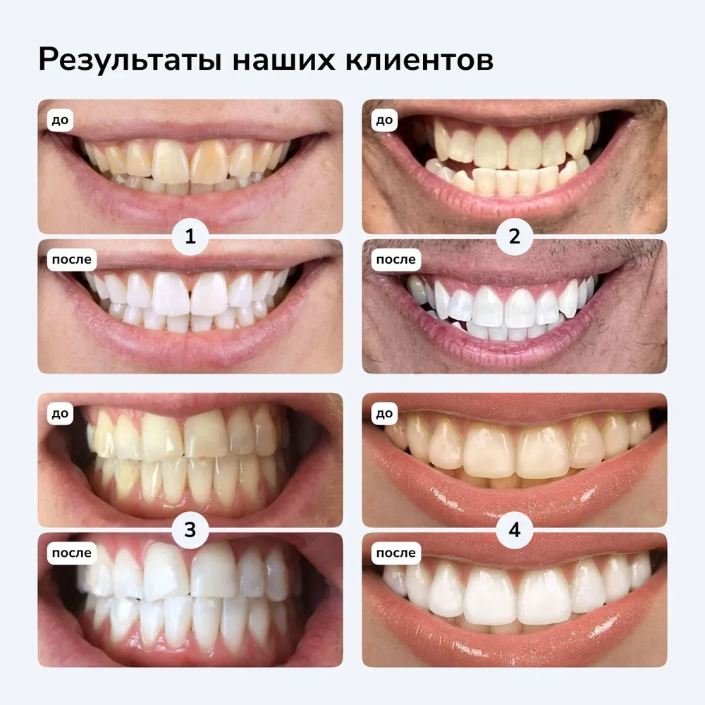 Smilebe Отбеливающие полоски для зубов, бережное отбеливание, 14 шт., на 7 дней, 14 шт, фото 4