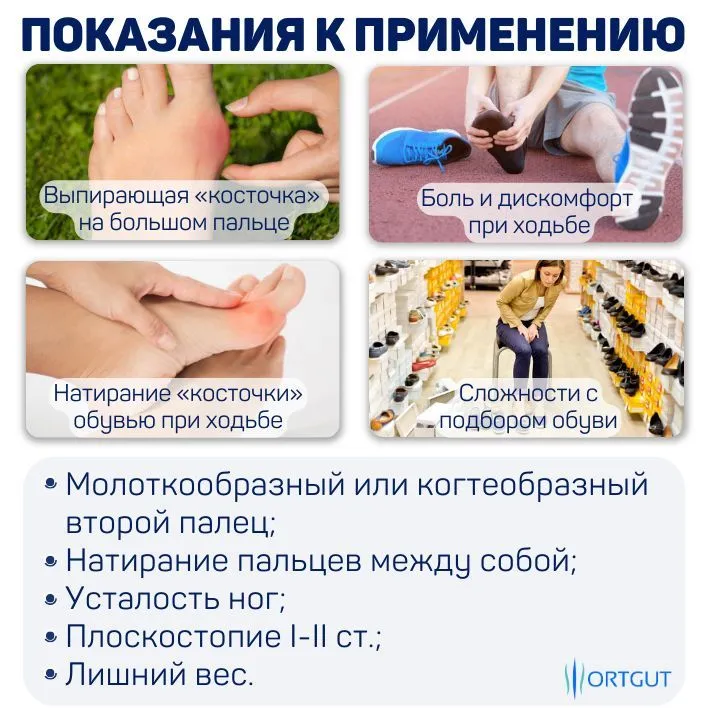 ORTGUT Межпальцевые перегородки для пальцев стопы / Силиконовые корректоры разделители от мозолей и натирания / Ортопедические подушечки вкладыши в обувь (фиксаторы для разделения пальцев ног) - S, вариант, фото 4