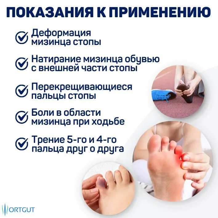 ORTGUT Силиконовый разделитель для пальцев ног / Фиксатор мизинца стопы с межпальцевыми перегородками / Гелевые накладки для комфортного размещения пальцев, вариант, фото 4