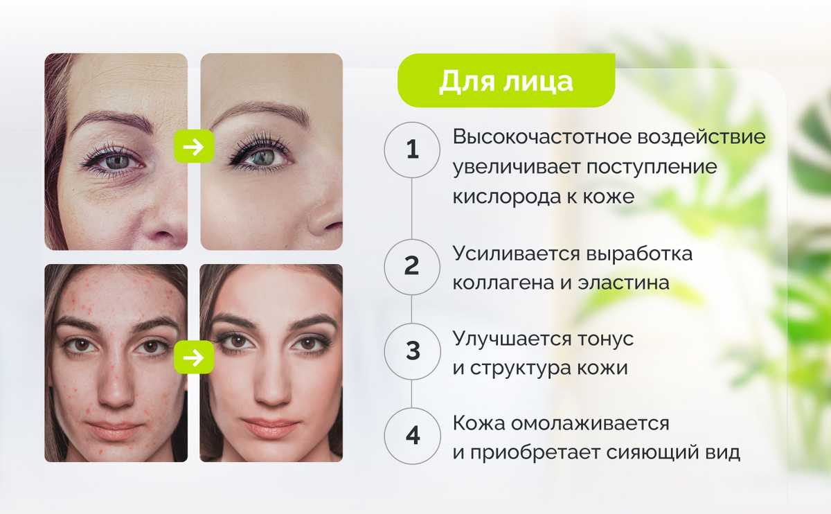 Дарсонваль аппарат для лица, волос и тела GESS DARS, профессиональный ...