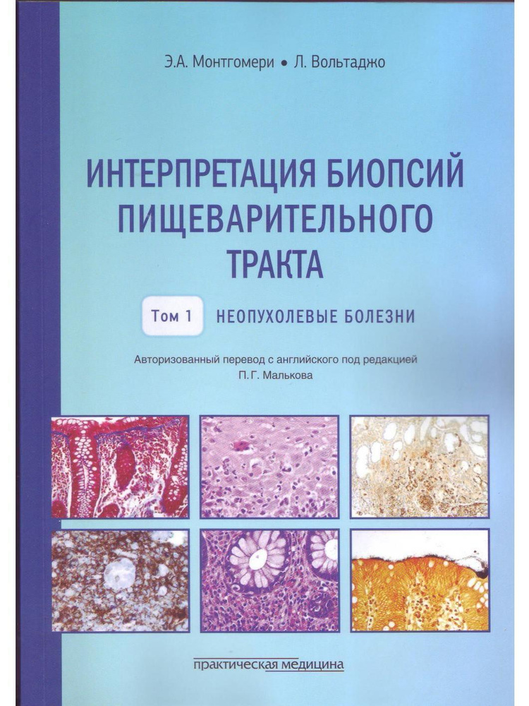 Интерпретация биопсий пищеварительного тракта. Неопухолевые болезни. Том 1  #1