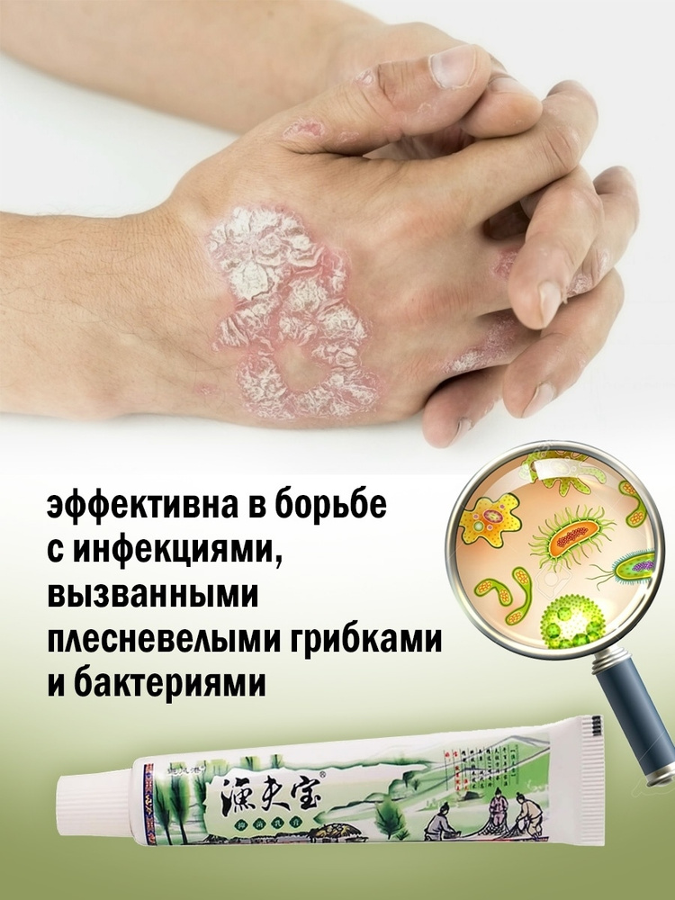 Заживляющая мазь "Сокровище рыбака" от псориаза, дерматита и экземы ...