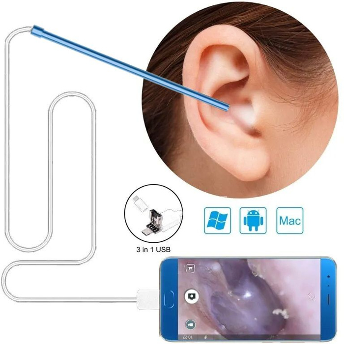 Электронный ушной эндоскоп отоскоп BSIDE с камерой и поддержкой Android ...