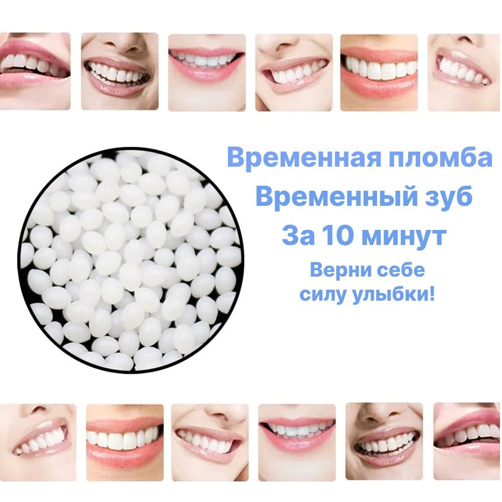 ВременнаяПломбаДляЗуба