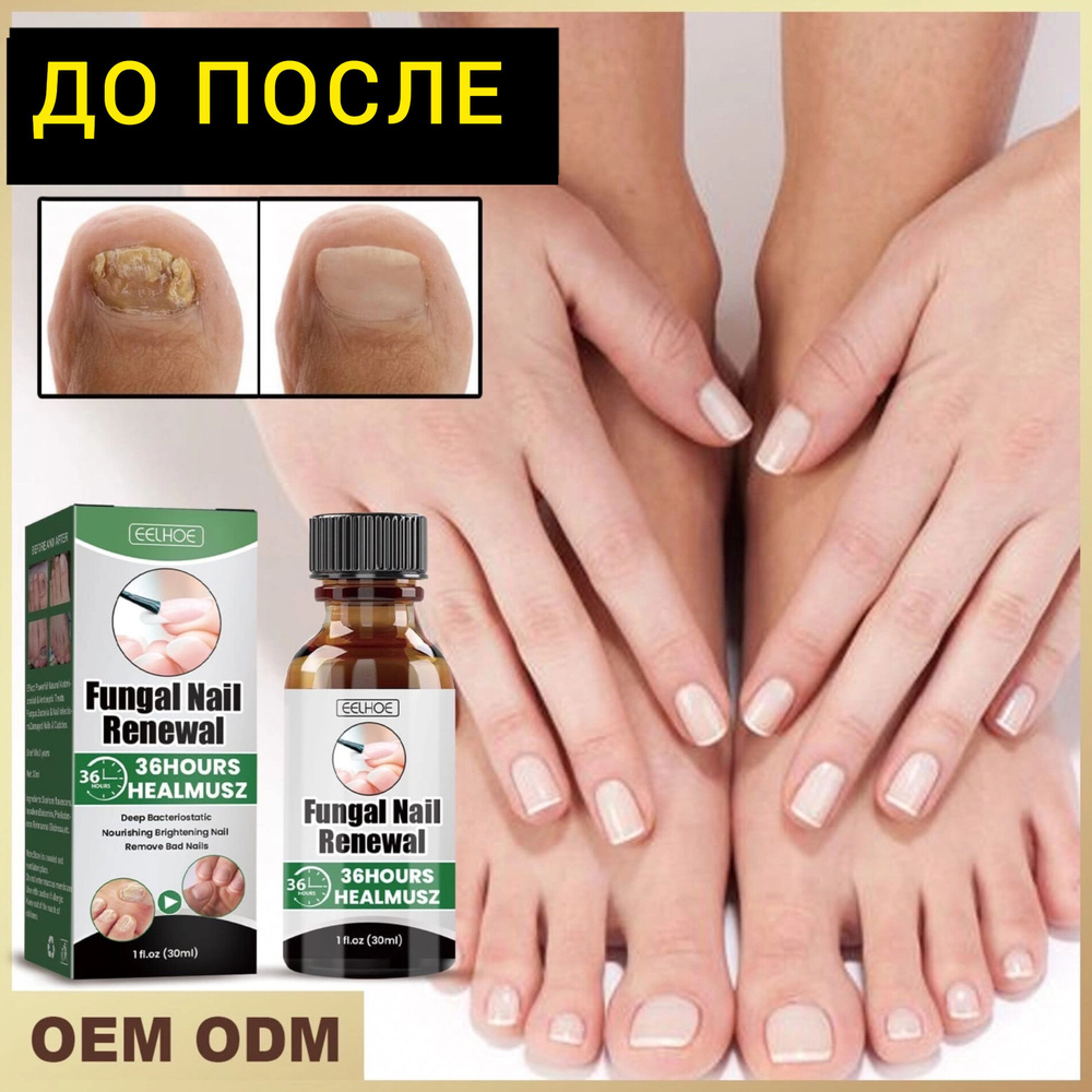 Средство от грибка fungal nail renewal для ногтей 30 мл - купить с  доставкой по выгодным ценам в интернет-магазине OZON (1162935088)