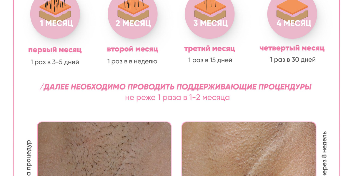 Домашний фотоэпилятор с функцией омоложения D'Evi Skin Pro купить на ...