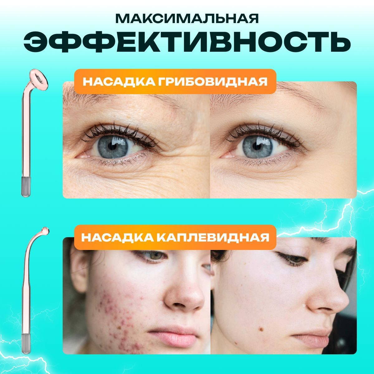 Moreover Дарсонваль аппарат для волос лица и тела с 4 насадками ...
