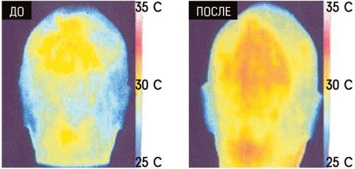 Массаж кожи головы: Во время ежедневного массажа, температура кожи головы повышается на 2 градуса, ускоряется кровообращение. Все это повышает тонус кожи, дарит приятные ощущения и расслабление.