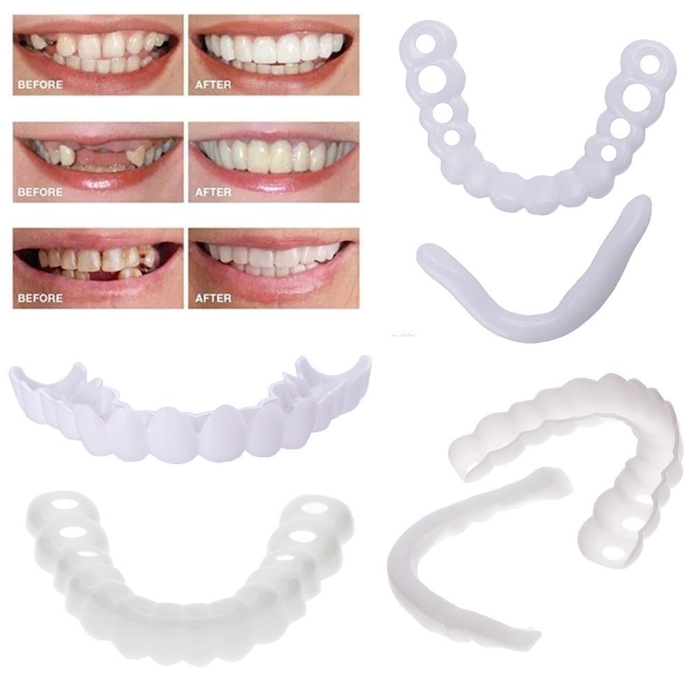 ВинирыверхниеинижниескрепежемNP