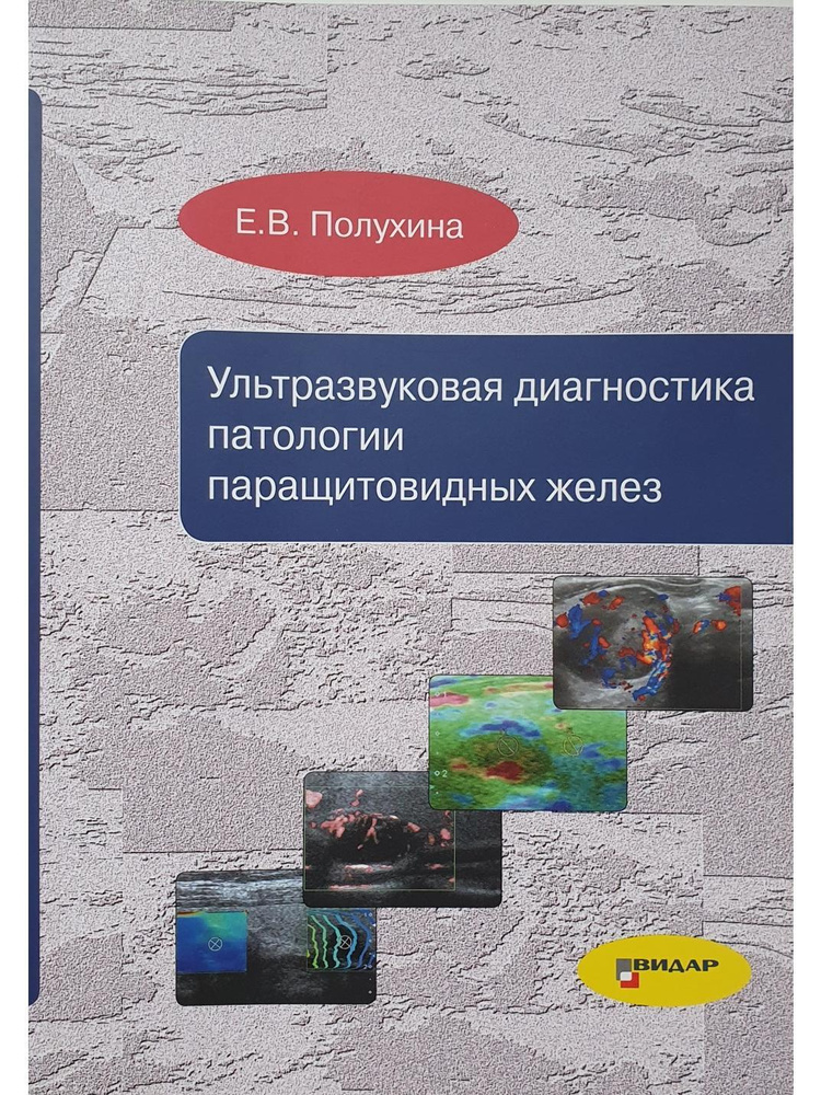 Ультразвуковая диагностика патологии паращитовидных желез | Полухина ...