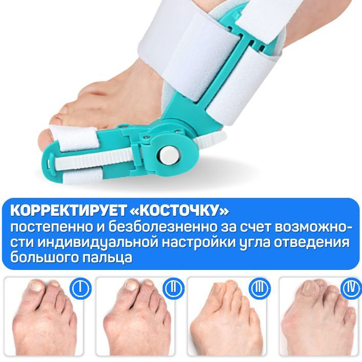 Вальгусная шарнирная шина ORTGUT SNAP FIX с регулировкой угла ...