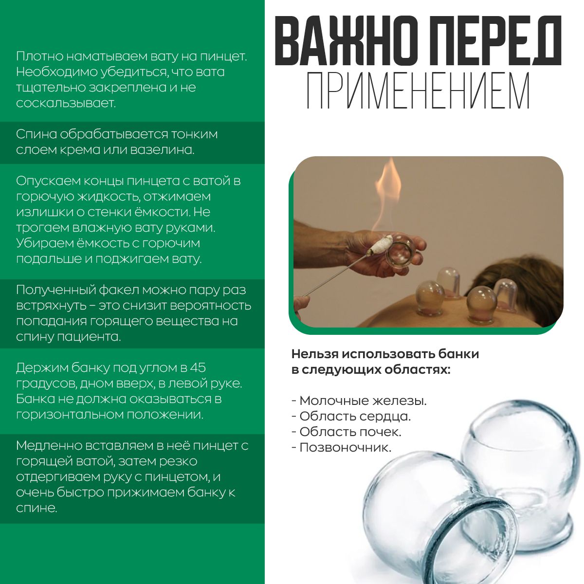 Массажные банки медицинские стеклянные вакуумные / стеклянные банки для ...