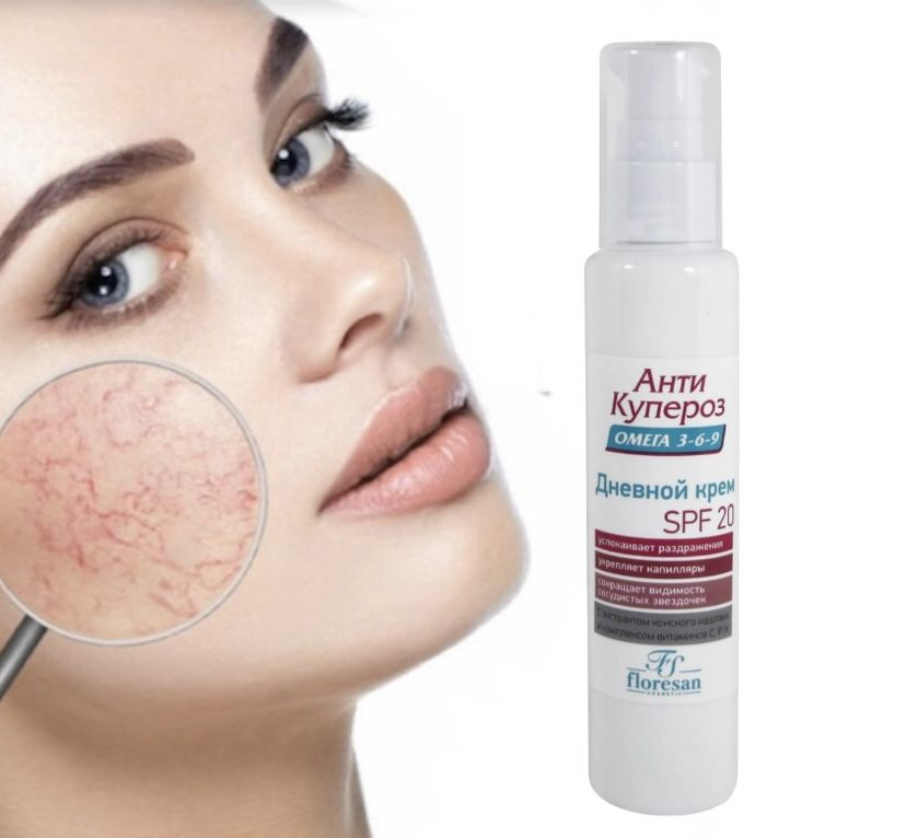 Дневной крем SPF 20 "Анти Купероз" - купить с доставкой по выгодным ...