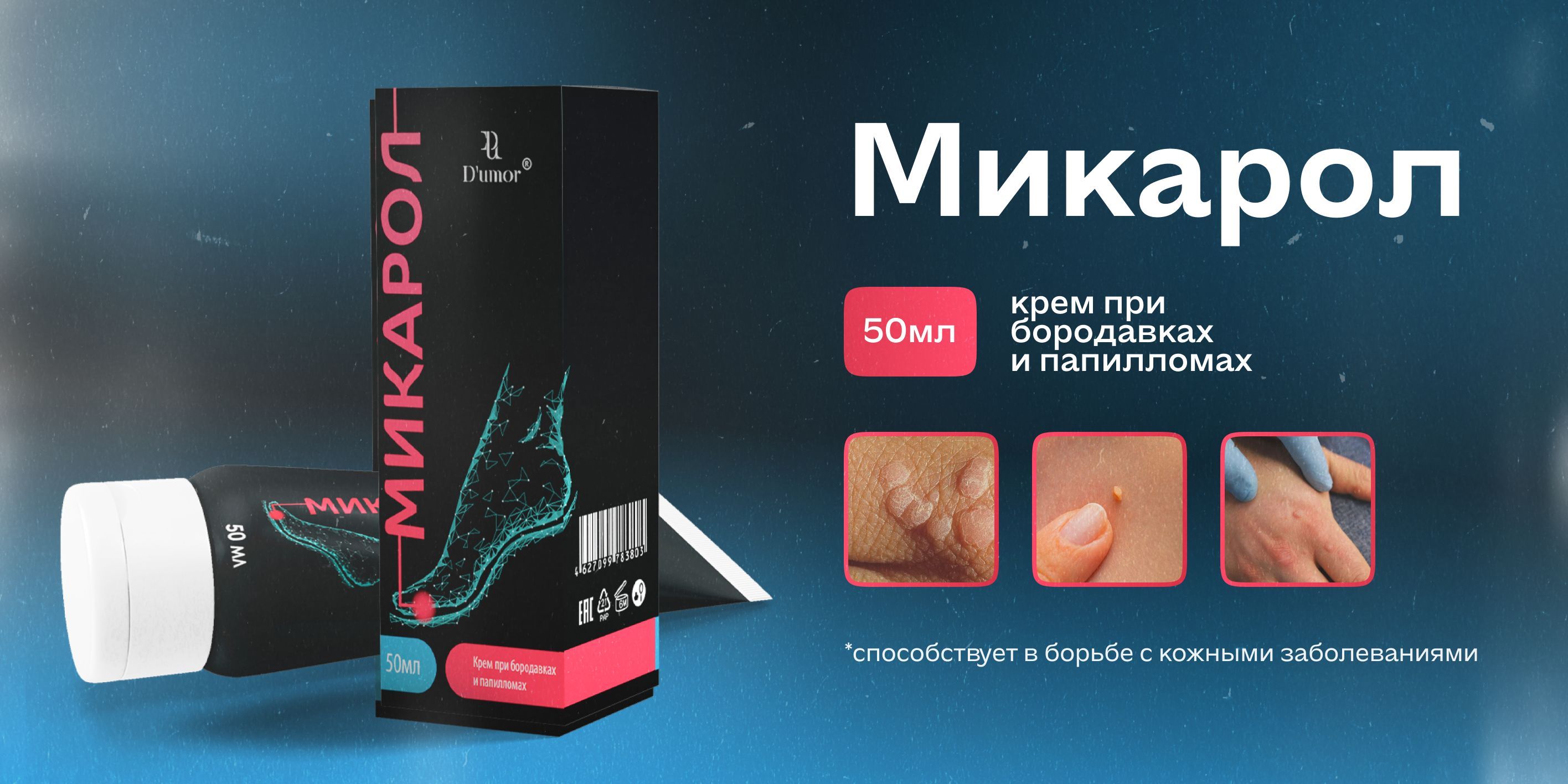 Микарол / Крем от папиллом, от бородавок, мазь для ног, от сухих ...