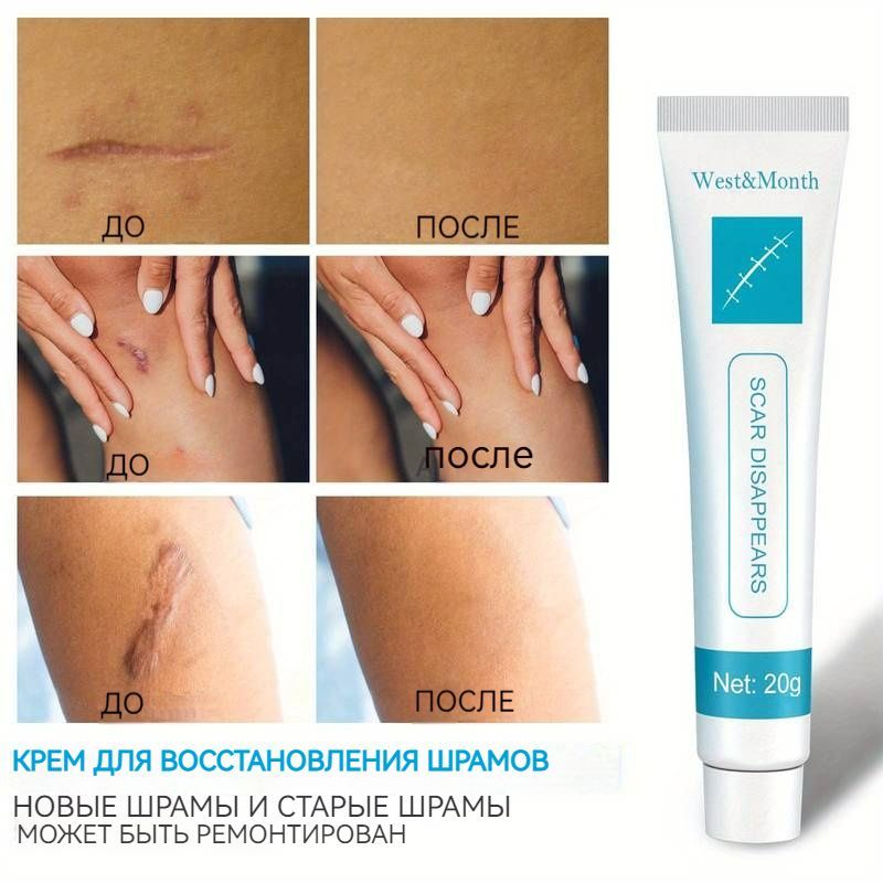 Травяной гель от шрамов от старых и новых рубцов - Эффективен при ...