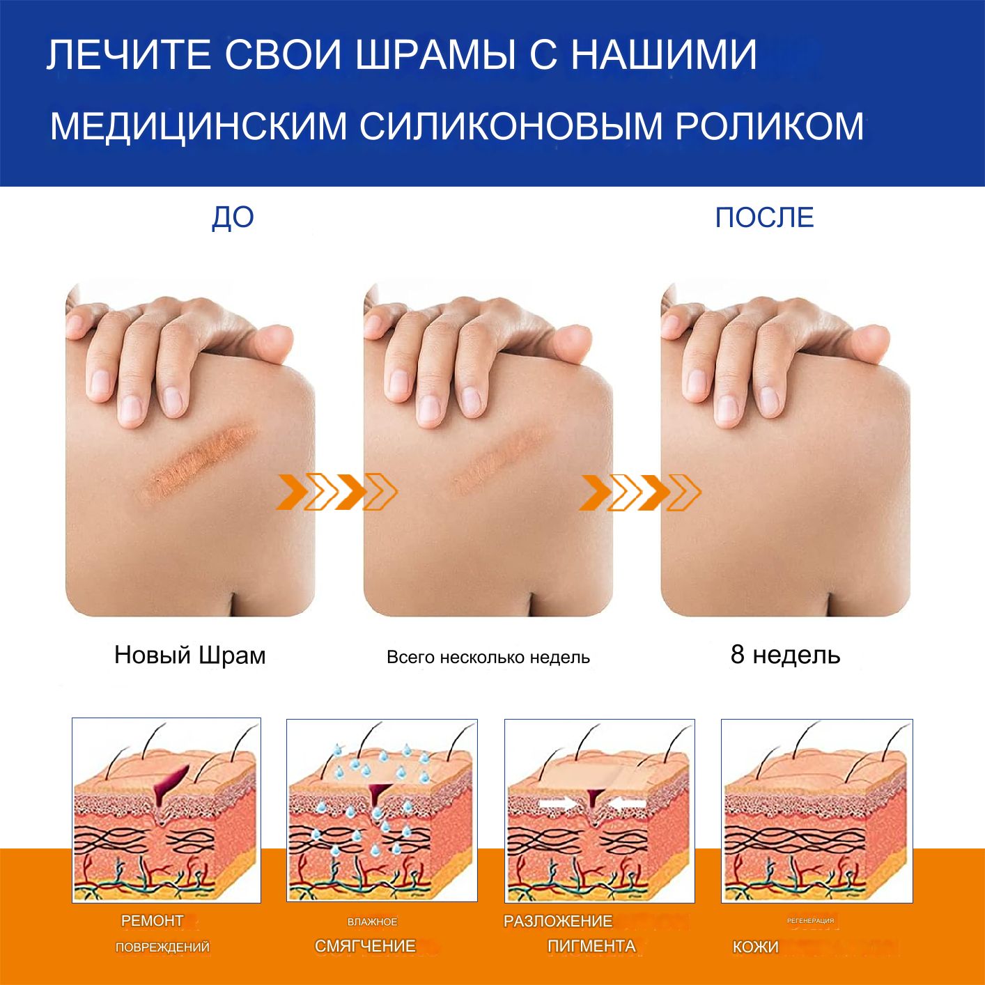 Силиконовый пластырь от шрамов и рубцов,пластырь от растяжек,рубцов ...