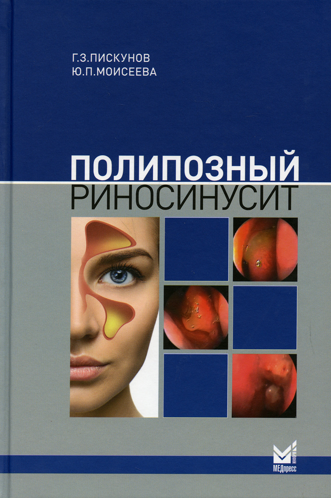 Полипозный риносинусит. 2-е изд., доп | Пискунов Геннадий Захарович  #1