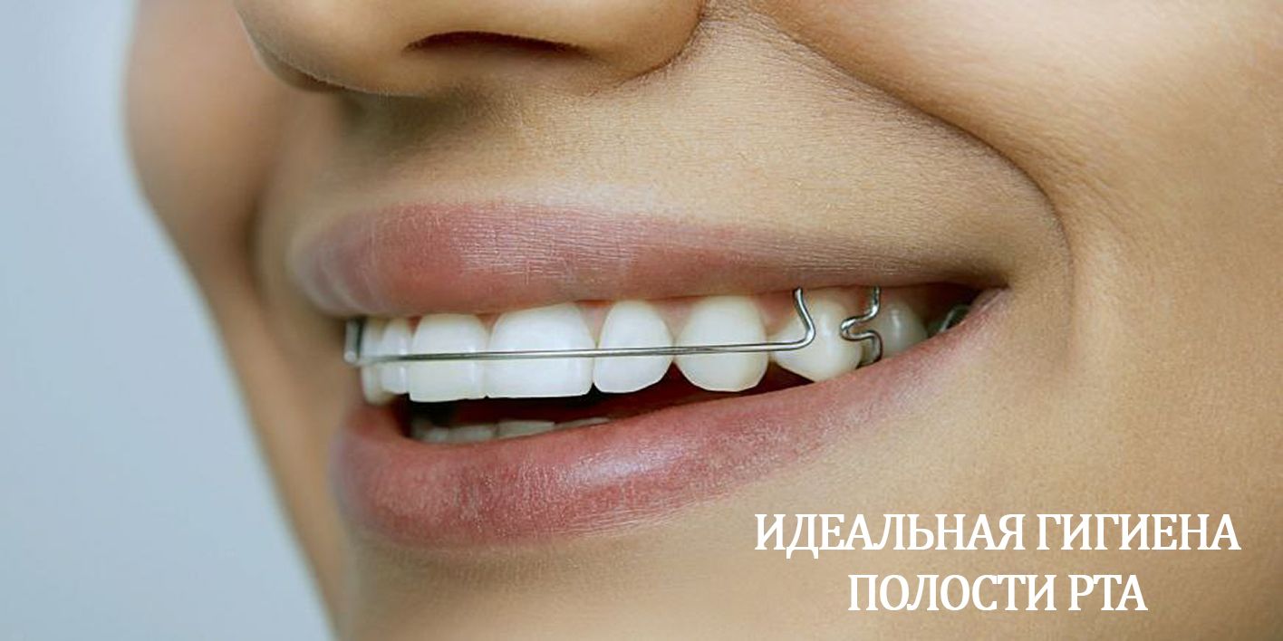 Поставили пластину на зубы. Ретейнеры ортодонтические. Пластины для зубов. Скобы для зубов. Скобы для выпрямления зубов.