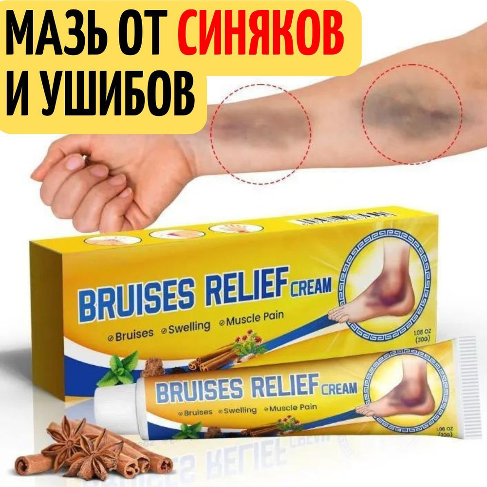 Кремы при ушибах и синяках