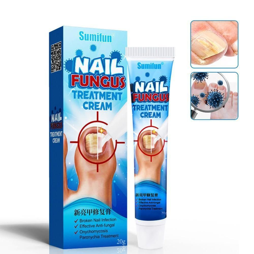 Травяной крем от грибка ногтей Sumifun Nail Fungus Treatment Cream, 20гр #1