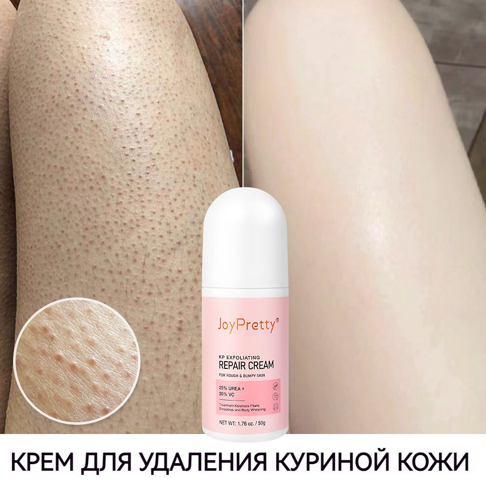 Пилинг #1