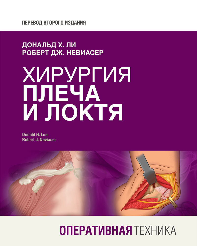 Хирургия плеча и локтя. Оперативная техника - купить с доставкой по ...