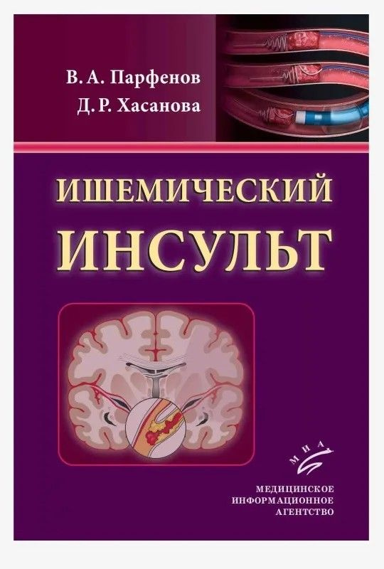 Ишемический инсульт - купить с доставкой по выгодным ценам в интернет ...