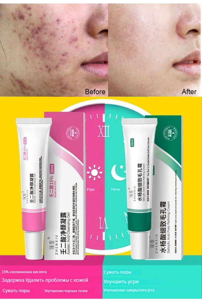 Комбинированный крем с салициловой кислотой и 15% азелаиновой кислотой ...
