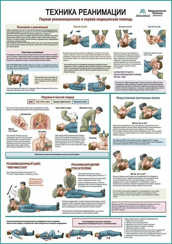 Техника реанимации, обучающий плакат глянцевый А2+, плотная фотобумага от 200г/м2  #1
