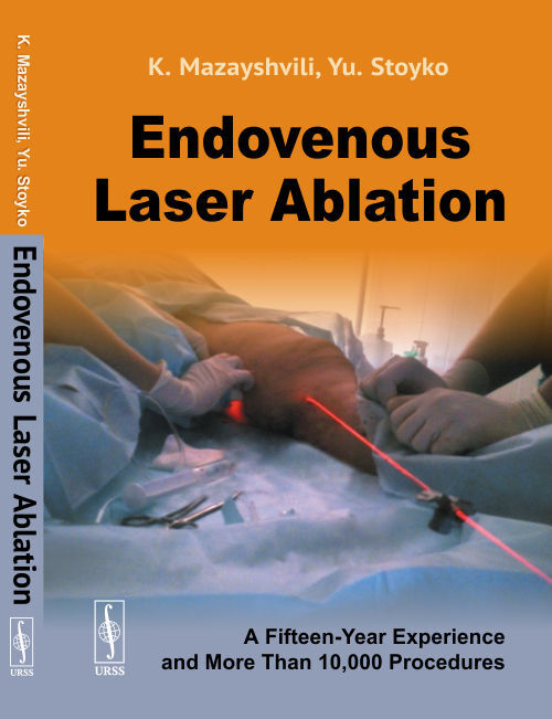 Endovenous Laser Ablation А FifteenYear Experience and More Than 10,000 Procedures купить с