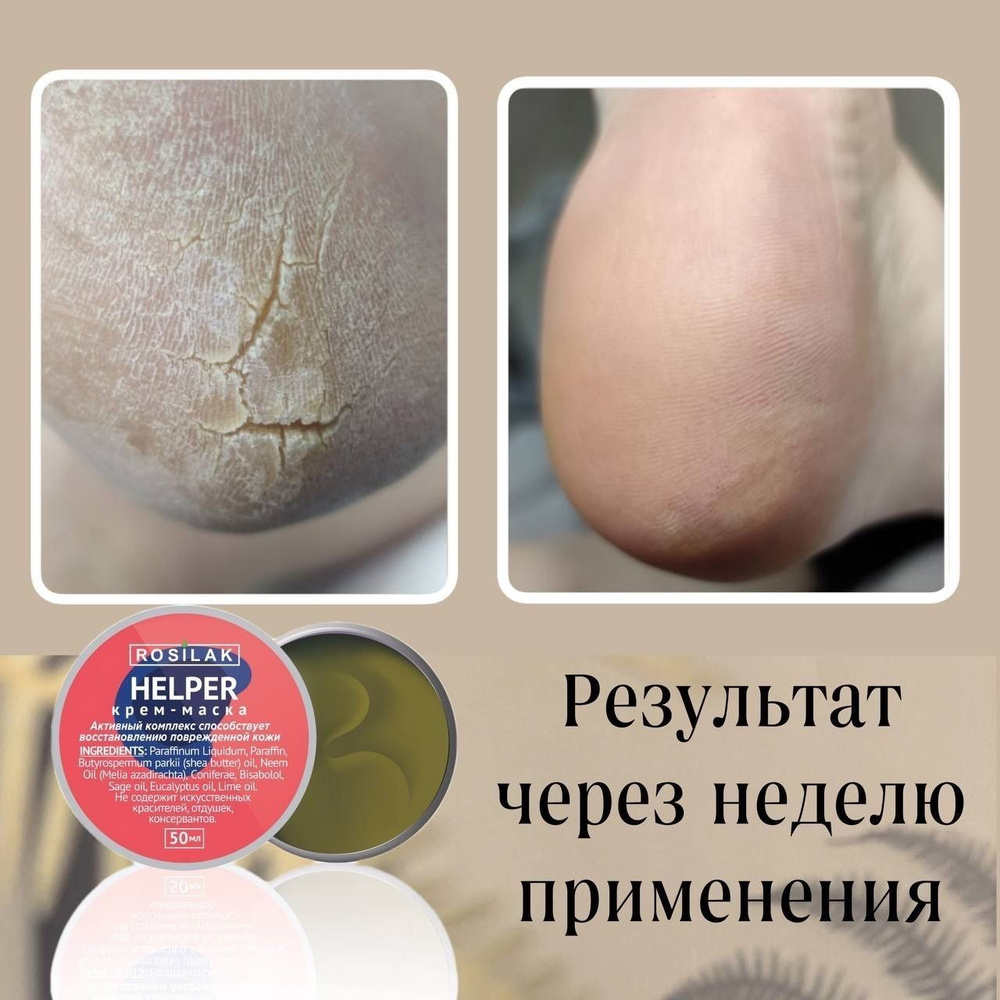 Крем от трещин на пятках и мозолей HELPER от пяточной шпоры - купить с ...
