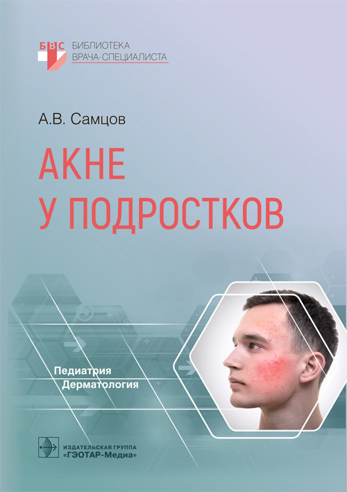 Акне у подростков #1