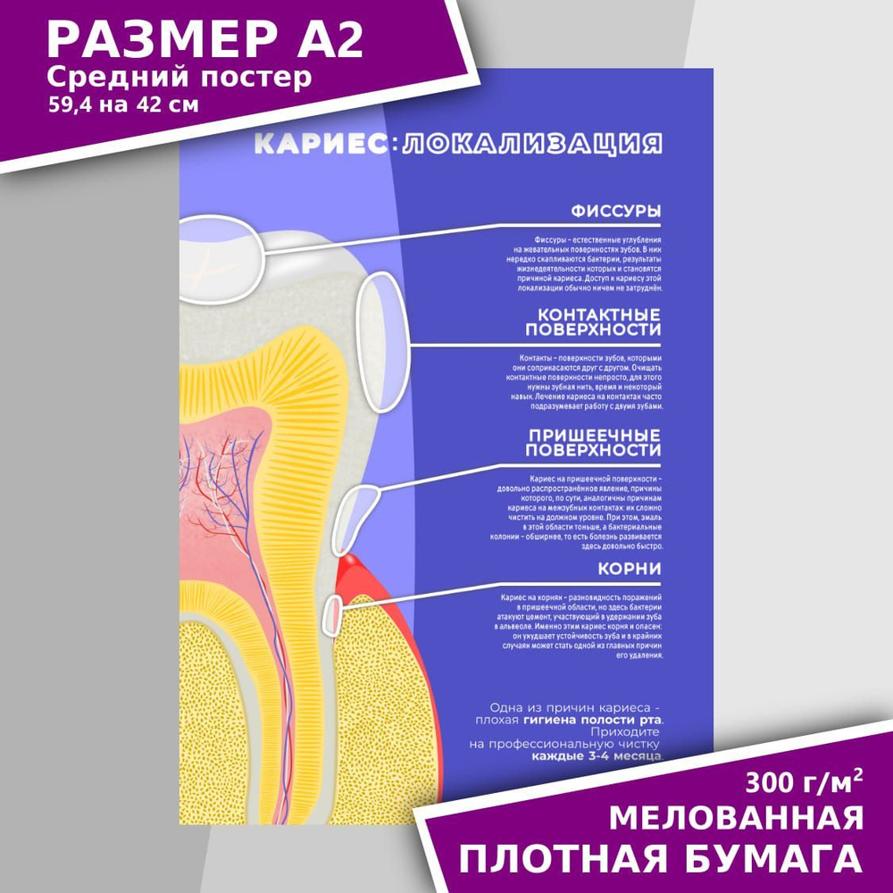 Стоманет Плакат 